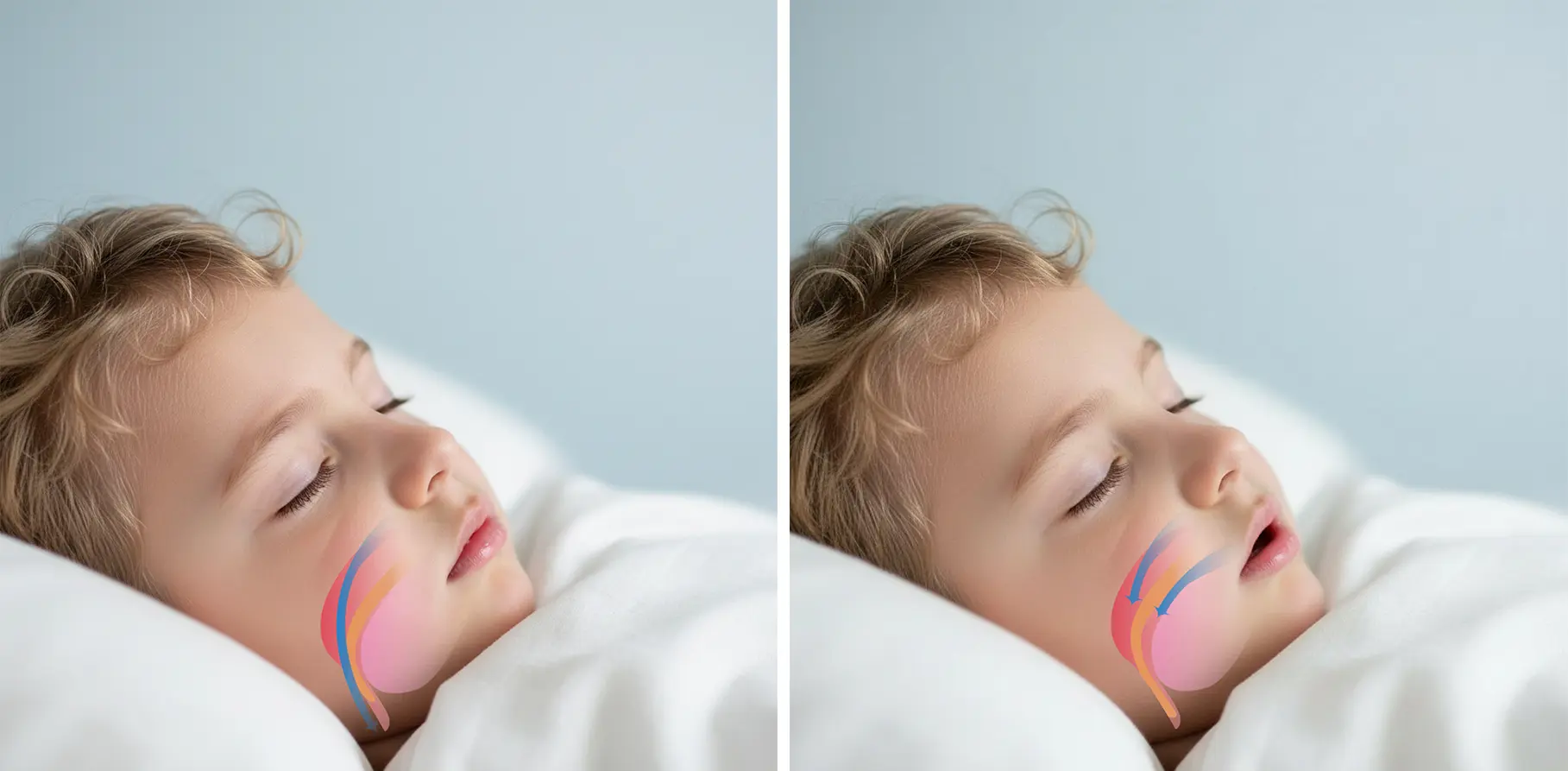 Airway image replacement